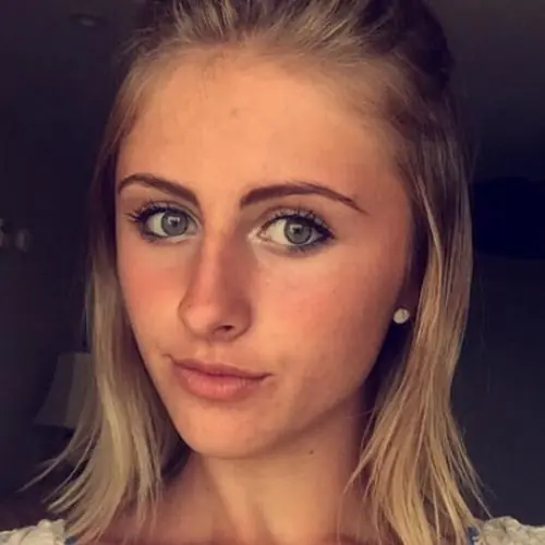 zungemundlippe image 0