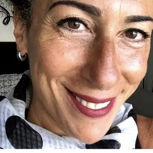 1furvielesbeim6 image 0