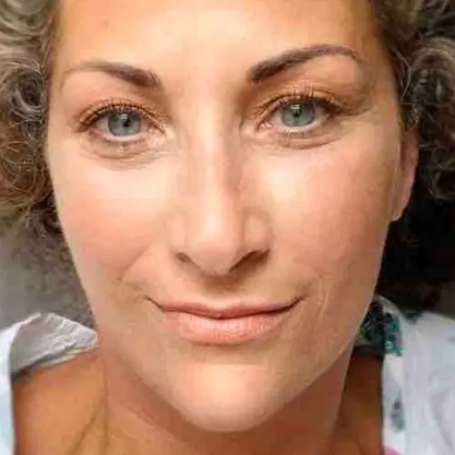 prallefrucht33 image 0