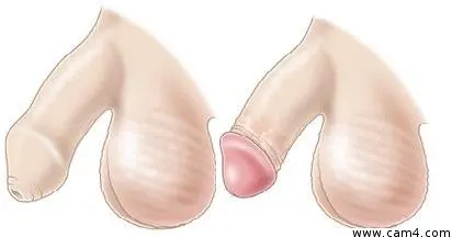 circcvmcisio image 0