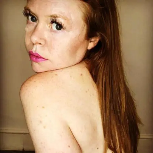 leberfleckkk image 0